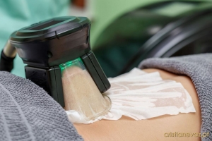 Criolipólise: no que consiste?