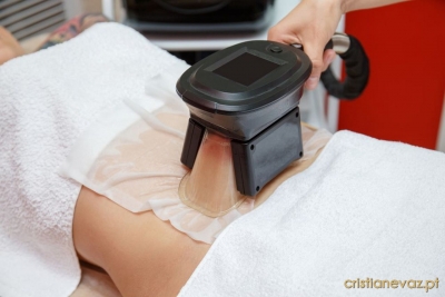 Criolipólise: Indicações e Contra-Indicações