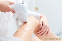 Depilação Laser Díodo